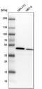Adenosine Kinase antibody, HPA038409, Atlas Antibodies, Western Blot image 