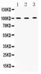 ADAM Metallopeptidase Domain 2 antibody, PA5-78724, Invitrogen Antibodies, Western Blot image 