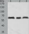 Tyrosinase antibody, TA323679, Origene, Western Blot image 