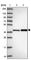 ARSA antibody, HPA045951, Atlas Antibodies, Western Blot image 