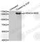 Histone Deacetylase 4 antibody, AP0359, ABclonal Technology, Western Blot image 