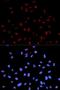 c-met antibody, LS-C335774, Lifespan Biosciences, Immunofluorescence image 
