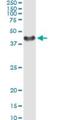 Small Glutamine Rich Tetratricopeptide Repeat Containing Alpha antibody, H00006449-M06, Novus Biologicals, Immunoprecipitation image 