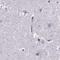 Secreted frizzled-related protein 4 antibody, NBP1-81866, Novus Biologicals, Immunohistochemistry paraffin image 