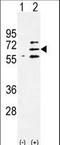 Poly(ADP-Ribose) Polymerase Family Member 6 antibody, LS-C100011, Lifespan Biosciences, Western Blot image 
