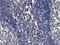 BCL2 Like 11 antibody, A01552-4, Boster Biological Technology, Immunohistochemistry paraffin image 