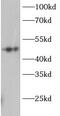 Glycogen Synthase Kinase 3 Alpha antibody, FNab10243, FineTest, Western Blot image 