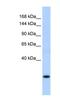 Protein SSX8 antibody, NBP1-79469, Novus Biologicals, Western Blot image 
