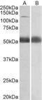 Coatomer Protein Complex Subunit Alpha antibody, TA311181, Origene, Western Blot image 