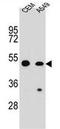 Caspase Recruitment Domain Family Member 16 antibody, AP51022PU-N, Origene, Western Blot image 
