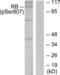 RB Transcriptional Corepressor 1 antibody, LS-C117469, Lifespan Biosciences, Western Blot image 