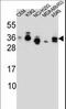 SSX Family Member 4B antibody, LS-C161527, Lifespan Biosciences, Western Blot image 