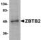 Zinc Finger And BTB Domain Containing 1 antibody, MBS150394, MyBioSource, Western Blot image 