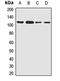 Polo Like Kinase 4 antibody, LS-C668347, Lifespan Biosciences, Western Blot image 