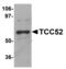 DDB1 And CUL4 Associated Factor 12 antibody, TA306965, Origene, Western Blot image 