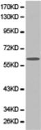 Golgi Associated, Gamma Adaptin Ear Containing, ARF Binding Protein 2 antibody, TA322356, Origene, Western Blot image 