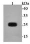 Protein-Glucosylgalactosylhydroxylysine Glucosidase antibody, orb154873, Biorbyt, Western Blot image 