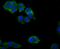 Zyxin antibody, A02365, Boster Biological Technology, Immunocytochemistry image 