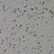 DNA Methyltransferase 3 Beta antibody, LS-C332279, Lifespan Biosciences, Immunohistochemistry paraffin image 