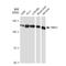 Transient Receptor Potential Cation Channel Subfamily C Member 1 antibody, GTX03230, GeneTex, Western Blot image 