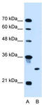Ring Finger Protein 39 antibody, TA330522, Origene, Western Blot image 