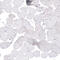 Tuj1 antibody, AMAb91395, Atlas Antibodies, Immunohistochemistry frozen image 