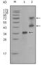 Ret Proto-Oncogene antibody, GTX83055, GeneTex, Western Blot image 