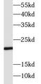 Suppressor Of Cytokine Signaling 1 antibody, FNab09926, FineTest, Western Blot image 