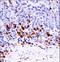 MAP3K6 antibody, LS-C164456, Lifespan Biosciences, Immunohistochemistry frozen image 