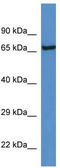 Kallikrein B1 antibody, TA338359, Origene, Western Blot image 