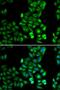 Dopamine Receptor D5 antibody, LS-C331655, Lifespan Biosciences, Immunofluorescence image 