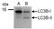Microtubule Associated Protein 1 Light Chain 3 Beta antibody, GTX100240, GeneTex, Western Blot image 