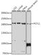 Pre-mRNA cleavage complex 2 protein Pcf11 antibody, A05372, Boster Biological Technology, Western Blot image 