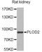 Procollagen-lysine,2-oxoglutarate 5-dioxygenase 2 antibody, STJ29026, St John