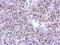 Poly(U)-binding-splicing factor PUF60 antibody, GTX629885, GeneTex, Immunohistochemistry paraffin image 