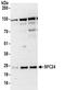 Kinetochore protein Spc24 antibody, NBP2-32105, Novus Biologicals, Western Blot image 