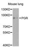 Progesterone Receptor antibody, MBS126258, MyBioSource, Western Blot image 