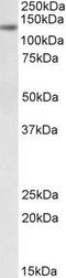 DIAPH1 antibody, GTX88212, GeneTex, Western Blot image 