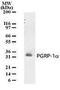 Peptidoglycan Recognition Protein 3 antibody, TA336467, Origene, Western Blot image 