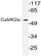Calcium/Calmodulin Dependent Protein Kinase II Alpha antibody, AP20970PU-N, Origene, Western Blot image 