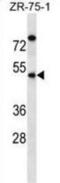 Essential Meiotic Structure-Specific Endonuclease Subunit 2 antibody, abx028759, Abbexa, Western Blot image 