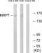 ATP Binding Cassette Subfamily C Member 10 antibody, LS-B13435, Lifespan Biosciences, Western Blot image 