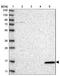 Vesicle Associated Membrane Protein 5 antibody, NBP1-85913, Novus Biologicals, Western Blot image 