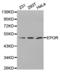 Erythropoietin Receptor antibody, TA327445, Origene, Western Blot image 