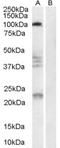 Reticulon 4 Receptor antibody, LS-C55182, Lifespan Biosciences, Western Blot image 