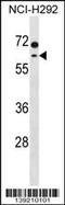 Methylcrotonoyl-CoA Carboxylase 2 antibody, 60-239, ProSci, Western Blot image 