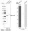 Shiftless Antiviral Inhibitor Of Ribosomal Frameshifting antibody, NBP1-90417, Novus Biologicals, Western Blot image 