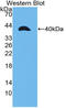 Matrix Metallopeptidase 23B antibody, LS-C314431, Lifespan Biosciences, Western Blot image 