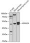 Alpha-2A adrenergic receptor antibody, 18-821, ProSci, Western Blot image 