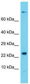 Dynactin Subunit 5 antibody, TA342885, Origene, Western Blot image 
